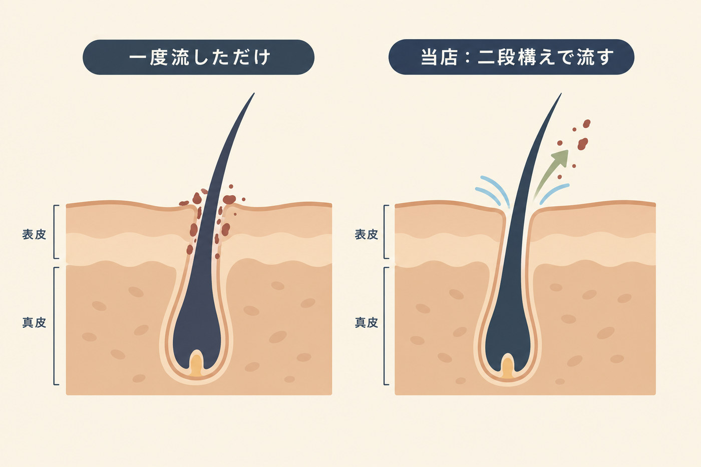 一度流しただけの毛穴と、2段構えで流したあとの毛穴の比較図